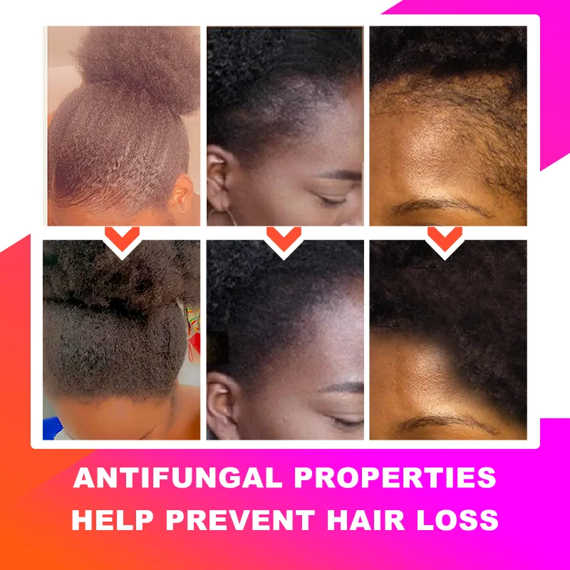 Fast Hair Growth Oil African Crazy Chebe Hair Oil Traction Alopecia Treatment Oil Natural Crazy Hair Regrowth anti Hair Care